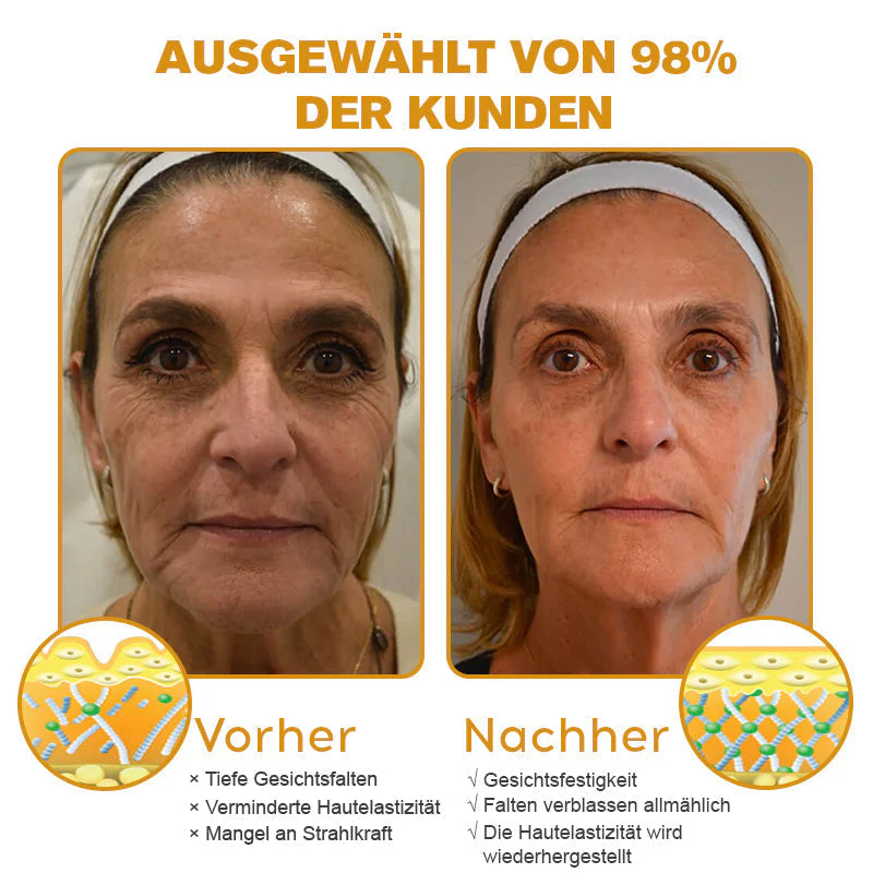🔥Letzter Tag der Aktion: 70 % Rabatt - ✨Furzero® Botox Bienenvenom Faltenentfernungscreme - Image 4