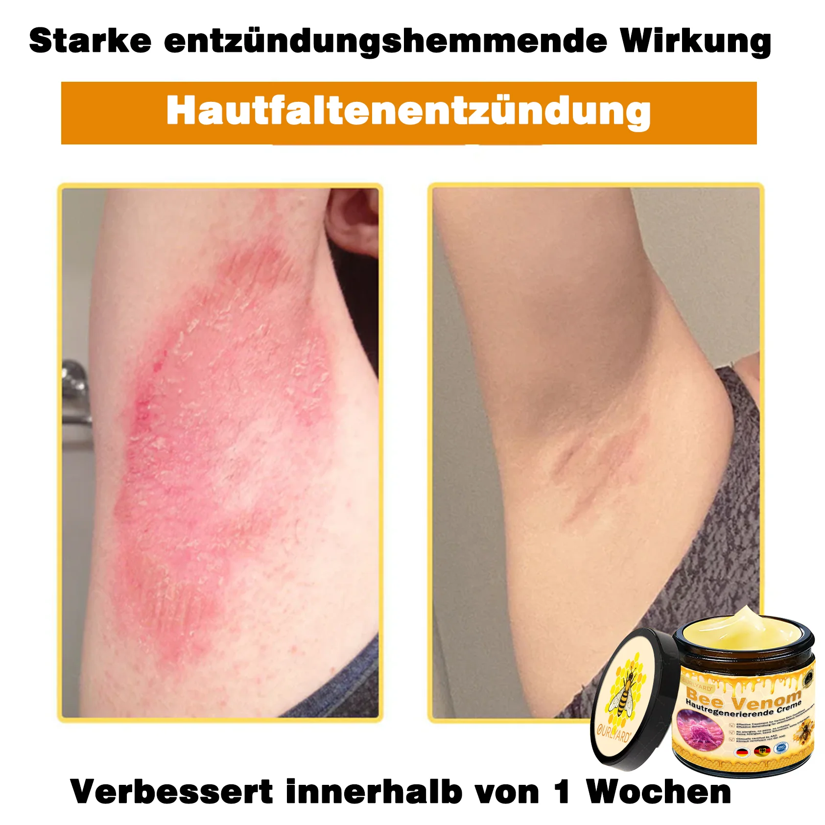 🌙🌙Ourlyard® Bienengift Pro Umfassende Creme — 🔥Begrenzte Zeit 80 % RABATT🔥 - Image 7