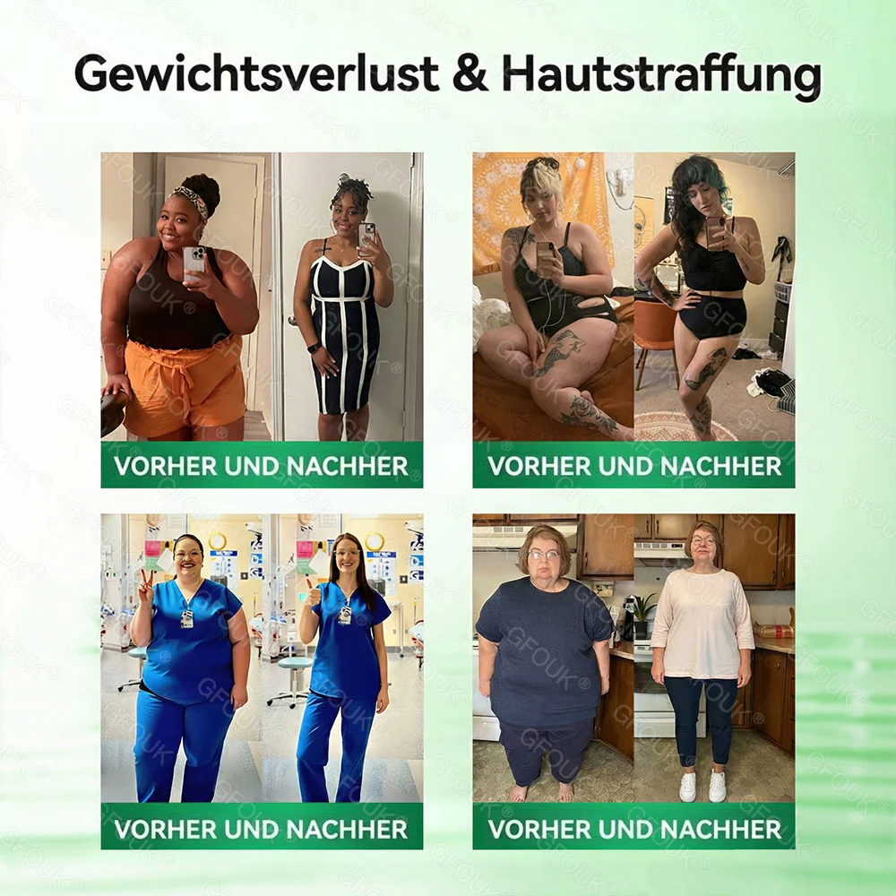 🇩🇪𝗢𝗳𝗳𝗶𝘇𝗶𝗲𝗹𝗹𝗲𝗿 𝗦𝗵𝗼𝗽 | ❤️‍🔥 𝗚𝗙𝗢𝗨𝗞® 𝗠𝗼𝗿𝗶𝗻𝗴𝗮 𝗕𝗲𝗿𝗯𝗲𝗿𝗶𝗻𝗲𝘅 𝗡𝗔𝗗+ 𝟭𝟬-𝗶𝗻-𝟭 𝗡𝗮𝗻𝗼-𝗠𝗶𝗸𝗿𝗼𝗻𝗮𝗱𝗲𝗹-𝗣𝗮𝘁𝗰𝗵 (𝗡𝘂𝗿 𝗲𝗶𝗻𝗺𝗮𝗹 𝘁ä𝗴𝗹𝗶𝗰𝗵, 𝘀𝗶𝗰𝗵𝘁𝗯𝗮𝗿𝗲 𝗩𝗲𝗿ä𝗻𝗱𝗲𝗿𝘂𝗻𝗴𝗲𝗻 𝗶𝗻 𝟳 𝗧𝗮𝗴𝗲𝗻) ✅ 𝗙ü𝗿 Ü𝗯𝗲𝗿𝗴𝗲𝘄𝗶𝗰𝗵𝘁, 𝗹𝗼𝗰𝗸𝗲𝗿𝗲 𝗛𝗮𝘂𝘁, 𝗗𝗶𝗮𝗯𝗲𝘁𝗲𝘀, 𝗦𝗰𝗵𝗹𝗮𝗳𝗮𝗽𝗻𝗼𝗲, 𝗚𝗲𝗹𝗲𝗻𝗸𝗽𝗿𝗼𝗯𝗹𝗲𝗺𝗲 𝘂𝗻𝗱 𝗺𝗲𝗵𝗿 - Image 2