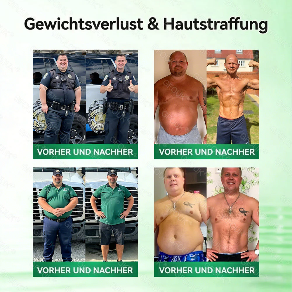 🇩🇪𝗢𝗳𝗳𝗶𝘇𝗶𝗲𝗹𝗹𝗲𝗿 𝗦𝗵𝗼𝗽 | ❤️‍🔥 𝗚𝗙𝗢𝗨𝗞® 𝗠𝗼𝗿𝗶𝗻𝗴𝗮 𝗕𝗲𝗿𝗯𝗲𝗿𝗶𝗻𝗲𝘅 𝗡𝗔𝗗+ 𝟭𝟬-𝗶𝗻-𝟭 𝗡𝗮𝗻𝗼-𝗠𝗶𝗸𝗿𝗼𝗻𝗮𝗱𝗲𝗹-𝗣𝗮𝘁𝗰𝗵 (𝗡𝘂𝗿 𝗲𝗶𝗻𝗺𝗮𝗹 𝘁ä𝗴𝗹𝗶𝗰𝗵, 𝘀𝗶𝗰𝗵𝘁𝗯𝗮𝗿𝗲 𝗩𝗲𝗿ä𝗻𝗱𝗲𝗿𝘂𝗻𝗴𝗲𝗻 𝗶𝗻 𝟳 𝗧𝗮𝗴𝗲𝗻) ✅ 𝗙ü𝗿 Ü𝗯𝗲𝗿𝗴𝗲𝘄𝗶𝗰𝗵𝘁, 𝗹𝗼𝗰𝗸𝗲𝗿𝗲 𝗛𝗮𝘂𝘁, 𝗗𝗶𝗮𝗯𝗲𝘁𝗲𝘀, 𝗦𝗰𝗵𝗹𝗮𝗳𝗮𝗽𝗻𝗼𝗲, 𝗚𝗲𝗹𝗲𝗻𝗸𝗽𝗿𝗼𝗯𝗹𝗲𝗺𝗲 𝘂𝗻𝗱 𝗺𝗲𝗵𝗿 - Image 3