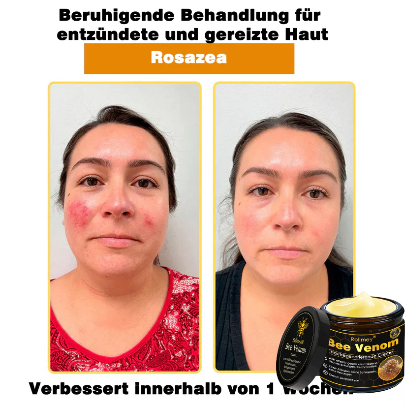 🎁Neuestes Modell: Rolimey® Bienengift Max Pflegecreme – Reparatureffekt um 65 % gesteigert 🔥 NUR NOCH 80 % RABATT - Image 13