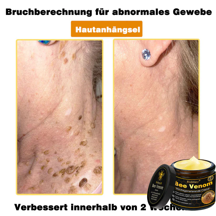 🎁Neuestes Modell: Rolimey® Bienengift Max Pflegecreme – Reparatureffekt um 65 % gesteigert 🔥 NUR NOCH 80 % RABATT - Image 18