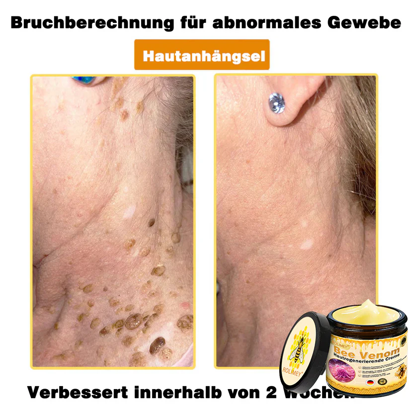 👑🌙Rolimey® Bienengift Pro Umfassende Creme — 🔥Begrenzte Zeit 80 % RABATT🔥 - Image 14
